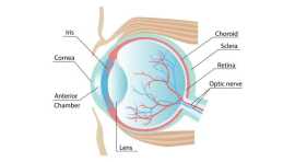 Reviving Vision with Corneal Transplant Surgery, St Kilda