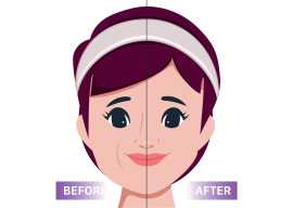 Best Anti-Ageing Treatment Clinic in Gurgaon, Gurgaon