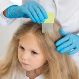 Expert Lice Treatment: Fast, Safe, and Effective S, Baton Rouge