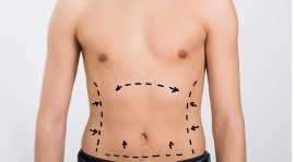 Liposuction in Lahore, Lahore