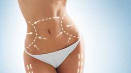 Liposuction in Pakistan Cost, Lahore